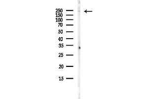anti-Mediator Complex Subunit 13-Like (MED13L) antibody