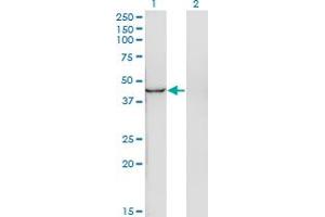 Western Blot analysis of INPP1 expression in transfected 293T cell line by INPP1 monoclonal antibody (M11), clone 4F9.
