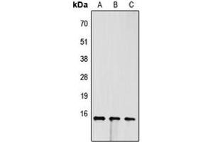 Western blot analysis of FABP4 expression in Jurkat (A), H9C2 (B), PC12 (C) whole cell lysates. (FABP4 antibody  (C-Term))