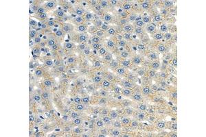 Immunohistochemistry of paraffin embedded mouse liver using CEACAM1 (ABIN7073315) at dilution of 1: 650 (400x lens)