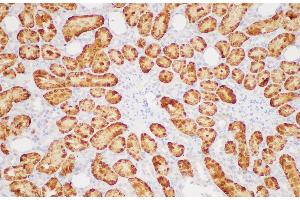 Immunohistochemistry of paraffin-embedded Rat kidney using GSTA1 Polycloanl Antibody at dilution of 1:200