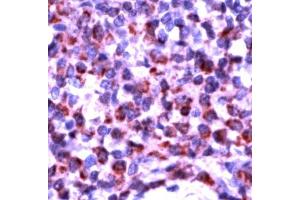 Human tonsil stained with Anti-Bak antibody (BAK1 antibody  (N-Term))