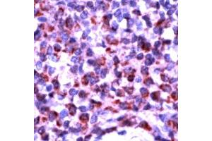 Human tonsil stained with Anti-Bak antibody