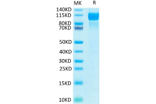 EGFR Protein (His-Avi Tag,Biotin)