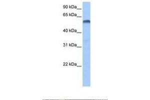 Image no. 1 for anti-Paired Box 3 (PAX3) (AA 144-193) antibody (ABIN6737680) (Paired Box 3 antibody  (AA 144-193))