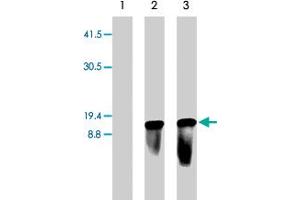 Western blot of 293 cells mock transfected (lane 1) or transiently transfected with pLenti6/TR lentiviral vector (lanes 2 & 3). (Blasticidin S Deaminase antibody  (N-Term))