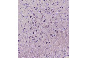 IHC analysis of NSE using anti-NSE antibody (ABIN6719549). (ENO2/NSE antibody)