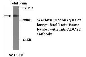 Image no. 1 for anti-Adenylate Cyclase 2 (Brain) (ADCY2) antibody (ABIN1574475)