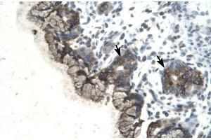 Human Stomach (PARP3 antibody  (C-Term))