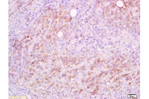 Formalin-fixed and paraffin embedded mouse lymphoma tissue labeled with Anti-CD5L/Api6 Polyclonal Antibody, Unconjugated (ABIN740985) at 1:200 followed by conjugation to the secondary antibody and DAB staining