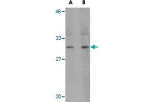 Western blot analysis of RASD2 in human colon tissue lysate with RASD2 polyclonal antibody  at (A) 1 and (B) 2 ug/mL .