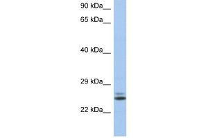 RAB15 antibody used at 1 ug/ml to detect target protein. (RAB15 antibody  (N-Term))