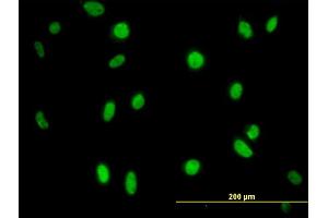 Immunofluorescence of monoclonal antibody to MPG on HeLa cell. (MPG antibody  (AA 1-90))