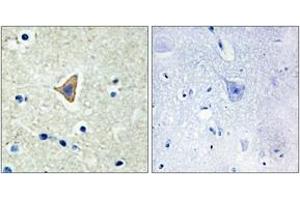 Immunohistochemistry analysis of paraffin-embedded human brain tissue, using CDH20 Antibody.