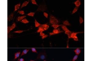 Immunofluorescence analysis of NIH-3T3 cells using DDB1 Polyclonal Antibody at dilution of 1:100 (40x lens). (DDB1 antibody)
