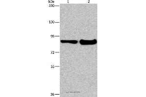 Western blot analysis of Mouse lung and liver tissue, using ECE1 Polyclonal Antibody at dilution of 1:1050 (MAPRE3 antibody)