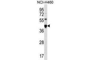 CEACAM18 Antibody (N-term) western blot analysis in NCI-H460 cell line lysates (35µg/lane). (CEACAM18 antibody  (N-Term))