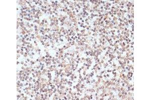 Immunohistochemistry of paraffin-embedded Human tonsil using Phospho-ERK1(T202/Y204)/ ERK2(T185/Y187) Polyclonal Antibody at dilution of 1:100 (40x lens). (ERK1 antibody  (pThr185, pThr202, pTyr187, pTyr204))