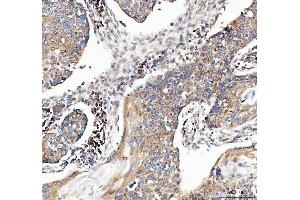 IHC analysis of MUT using anti-MUT antibody (ABIN4886676). (MUT antibody  (N-Term))