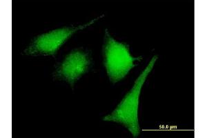 Immunofluorescence of purified MaxPab rabbit antibody to MAP2K2 on HeLa cell. (MEK2 antibody  (AA 1-400))