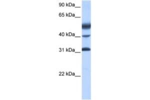 Western Blotting (WB) image for anti-Activating Transcription Factor 1 (AFT1) antibody (ABIN2461743) (AFT1 antibody)