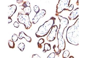IHC testing of placenta stained with HCG-beta antibody (HCGb/54).
