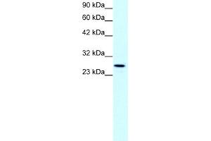 WB Suggested Anti-CLDN13 Antibody Titration:  1. (Claudin 13 (CLDN13) (C-Term) antibody)