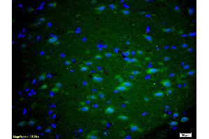 Formalin-fixed and paraffin embedded rat brain labeled with Anti GRM5/mGluR5 Polyclonal Antibody, Unconjugated (ABIN673914) at 1:200 followed by conjugation to the secondary antibody Goat Anti-Rabbit IgG, FITC conjugated used at 1:200 dilution for 40 minutes at 37°C and DAPI staining. (Metabotropic Glutamate Receptor 5 antibody  (AA 201-300))