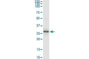 NAT6 MaxPab rabbit polyclonal antibody. (NAT6 antibody  (AA 1-308))