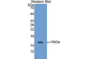 Western Blotting (WB) image for anti-Hexosaminidase B (Beta Polypeptide) (HEXB) (AA 101-217) antibody (ABIN3208193) (HEXB antibody  (AA 101-217))