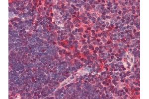 Image no. 1 for anti-Chemokine (C-X-C Motif) Receptor 6 (CXCR6) antibody (ABIN372833) (CXCR6 antibody)