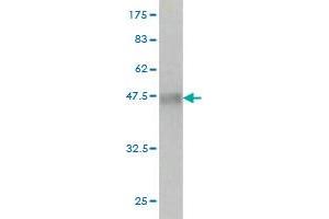 Western Blot detection against Immunogen (36. (CHEK2 antibody  (AA 1-100))