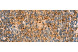 Immunohistochemistry of paraffin-embedded Human tonsil tissue using IFITM2 Polyclonal Antibody at dilution of 1:25(x200) (IFITM2 antibody)