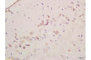 Formalin-fixed and paraffin embedded mouse brain labeled with Anti-Cyclooxygenase-2 Polyclonal Antibody, Unconjugated  at 1:200 followed by conjugation to the secondary antibody and DAB staining (PTGS2 antibody  (AA 301-400))
