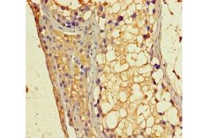 Immunohistochemistry of paraffin-embedded human testis tissue using ABIN7154785 at dilution of 1:100 (GBP6 antibody  (AA 401-600))