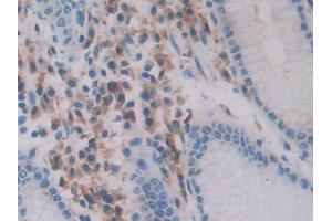 DAB staining on IHC-P; Samples: Human Stomach Tissue (Chemerin antibody  (AA 33-158))