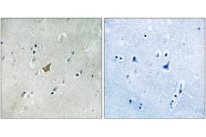 Immunohistochemistry analysis of paraffin-embedded human brain, using EPHA3/4/5 (Phospho-Tyr779/833) Antibody. (EPH Receptor A3 antibody  (pTyr779))