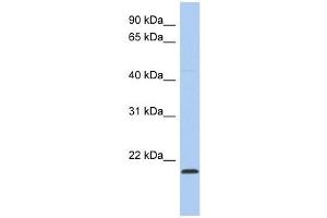 RWDD4A antibody used at 1 ug/ml to detect target protein. (RWDD4A antibody  (Middle Region))