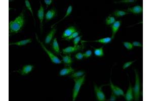 Immunofluorescence staining of Hela cells with ABIN7172295 at 1:105, counter-stained with DAPI. (TOM1L1 antibody  (AA 296-476))