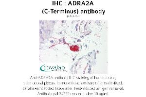 Image no. 1 for anti-Alpha-2A Adrenergic Receptor (ADRA2A) antibody (ABIN1731578)