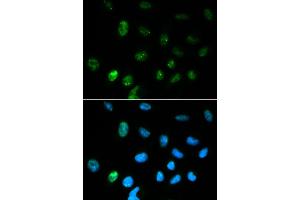 Immunofluorescence analysis of HepG2 cell using CGA antibody.