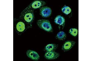 Immunofluorescence (IF) image for anti-SMAD Family Member 4 (SMAD4) (pThr277) antibody (ABIN3001788) (SMAD4 antibody  (pThr277))