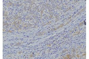 ABIN6277564 at 1/100 staining Human gastric tissue by IHC-P. (CYB5A antibody  (Internal Region))
