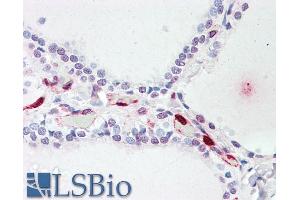 ABIN238640 (5µg/ml) staining of paraffin embedded Human Thyroid. (ATP13A1 antibody  (Internal Region))