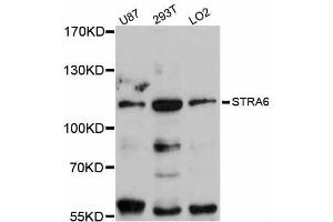 Western blot analysis of extracts of various cell lines, using STRA6 antibody (ABIN5998994) at 1:3000 dilution. (STRA6 antibody)