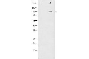 Phospholipase C gamma 2 antibody  (pTyr753)