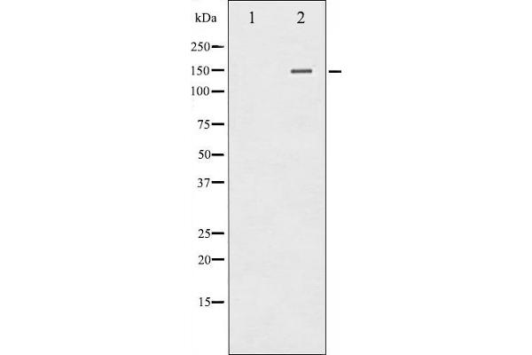 Phospholipase C gamma 2 antibody  (pTyr753)