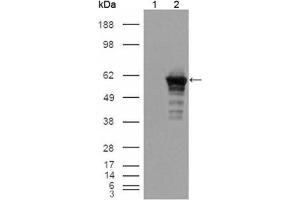 Western blot analysis using Desmin antibody against HEK293T cells transfected with the pCMV6-ENTRY control (1) and pCMV6-ENTRY Desmin cDNA (2). (Desmin antibody)