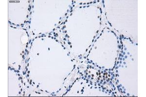 Immunohistochemical staining of paraffin-embedded Kidney tissue using anti-PSMA7mouse monoclonal antibody. (PSMA7 antibody)