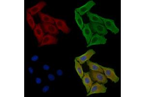 ABIN6256932 and ABIN6275042 staining Hela cells by IF/ICC. (Coxsackie Adenovirus Receptor antibody  (N-Term))